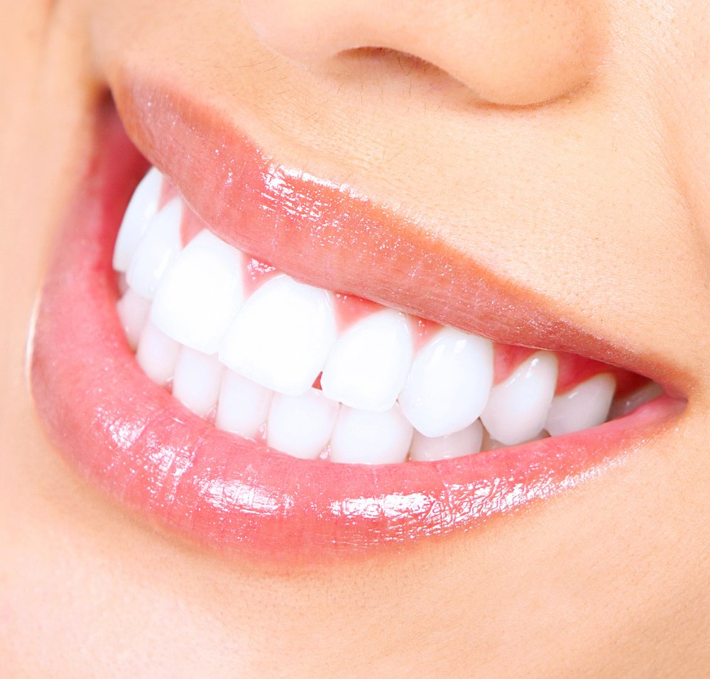 Why you should consider in office teeth whitening